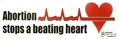 "Abortion Stops A Beating Heart" Bumper Sticker